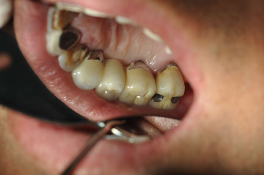 %_tempFileNameIMplant%2040b8%