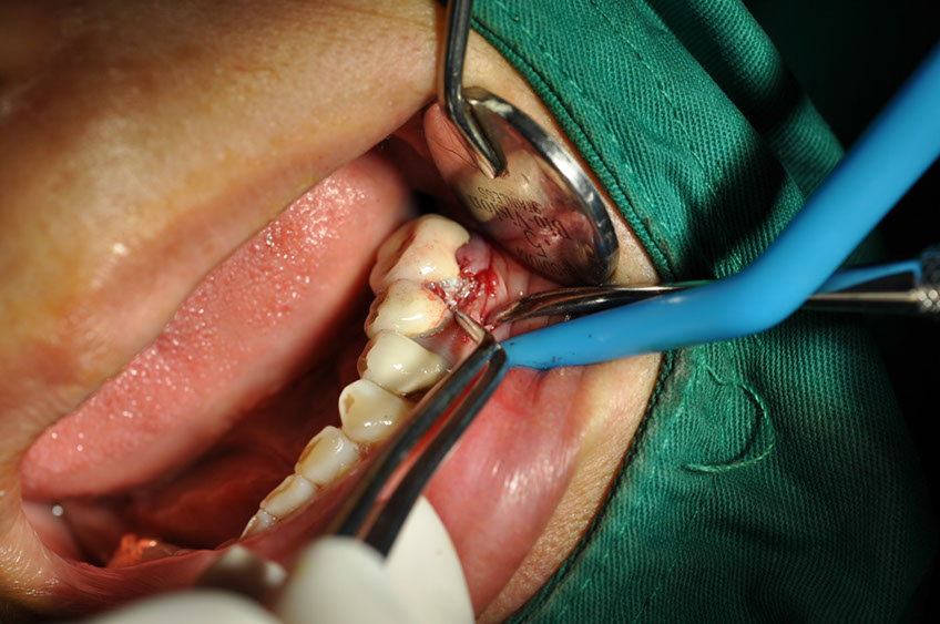 %_tempFileNameIMplant%2058a3%