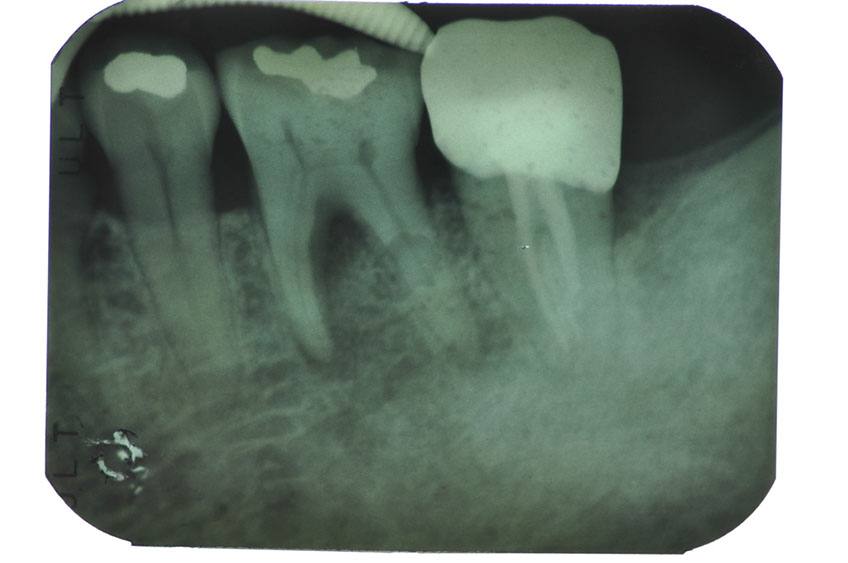 %_tempFileNameImplant%20104a1%