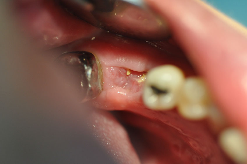 %_tempFileNameImplant%20104a7%