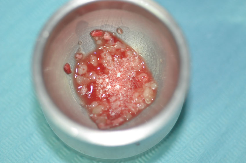 %_tempFileNameImplant%20104b3%