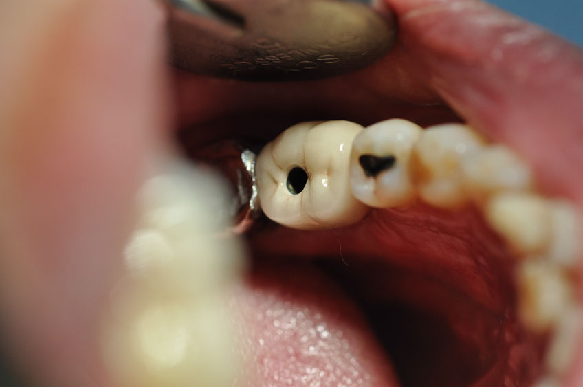 %_tempFileNameImplant%20104c2%
