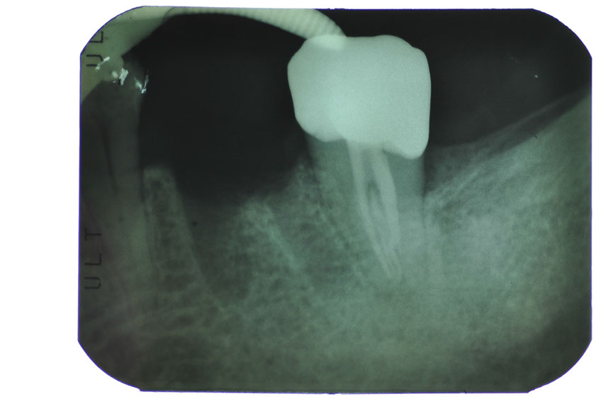 %_tempFileNameImplant%20104d1%