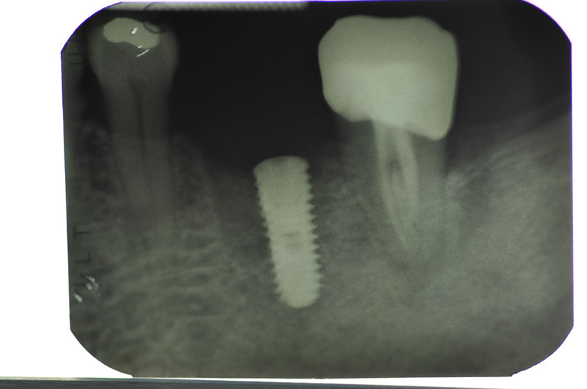 %_tempFileNameImplant%20104d4%