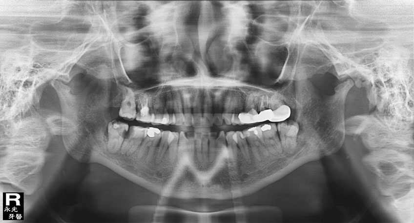 %_tempFileNameImplant%20105a2%