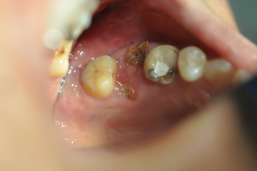 %_tempFileNameImplant%20105a3%