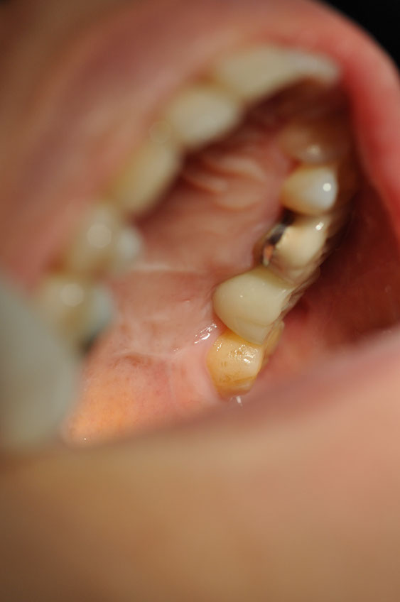 %_tempFileNameImplant%20105c2%