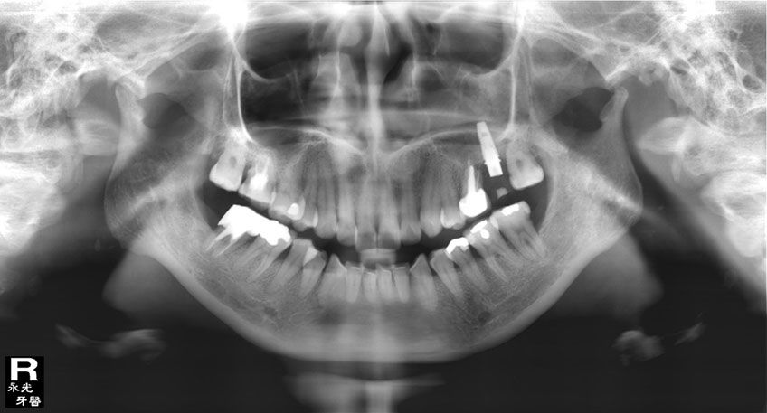 %_tempFileNameImplant%20105d1%