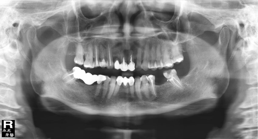 %_tempFileNameImplant%20107a1%