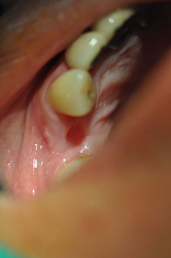 %_tempFileNameImplant%20107a3%