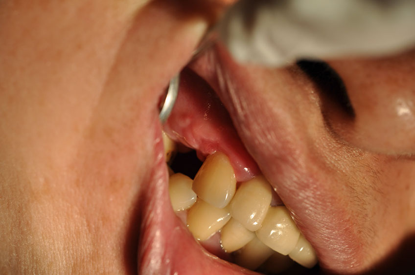 %_tempFileNameImplant%20107b9%