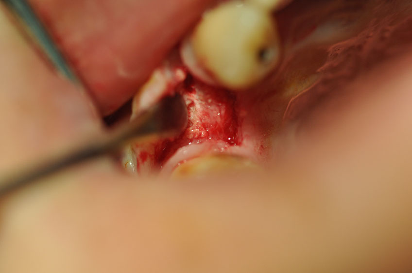 %_tempFileNameImplant%20107c1%