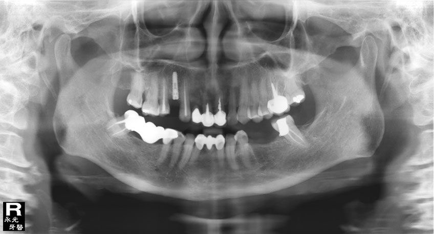 %_tempFileNameImplant%20107c8%