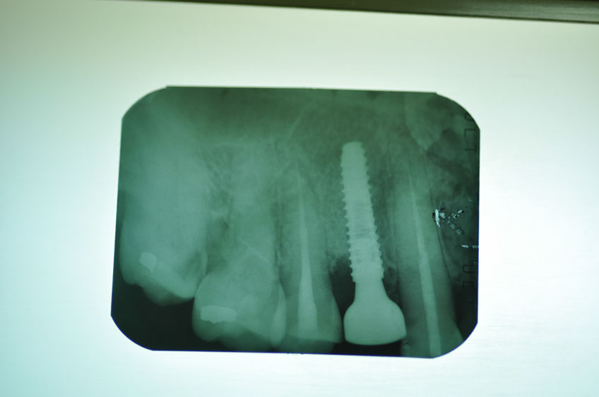 %_tempFileNameImplant%20107d3%