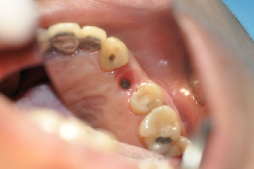 %_tempFileNameImplant%20107d4%