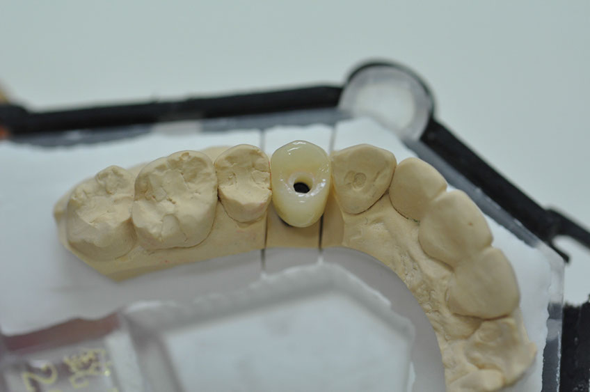 %_tempFileNameImplant%20107d5%