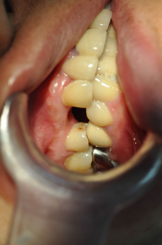 %_tempFileNameImplant%20107d6%