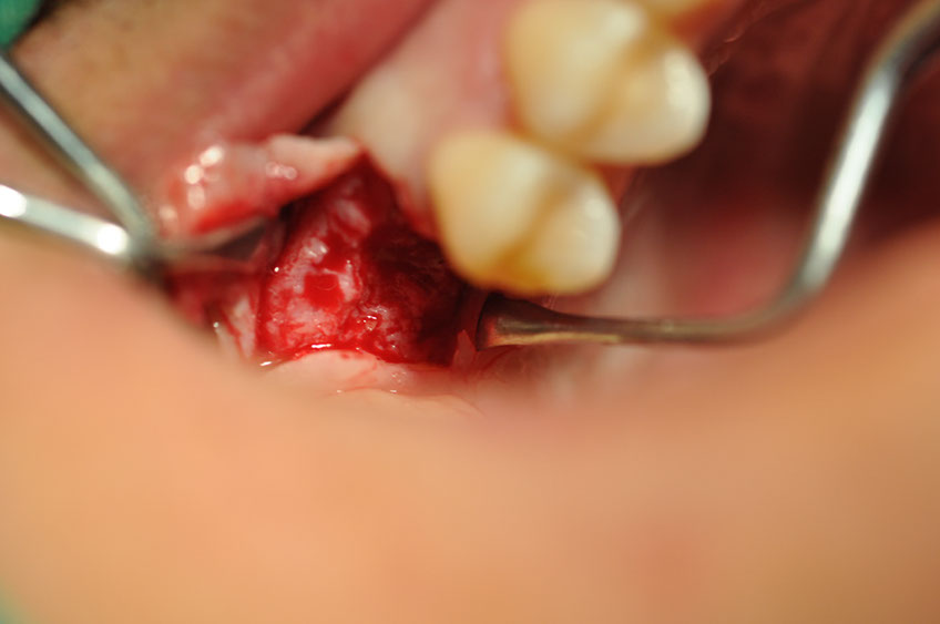 %_tempFileNameImplant%20108b5%