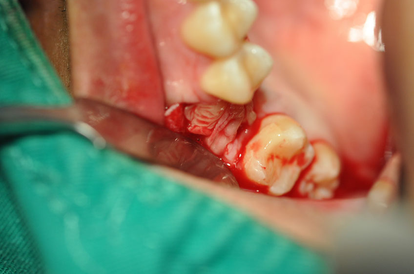 %_tempFileNameImplant%20108b7%