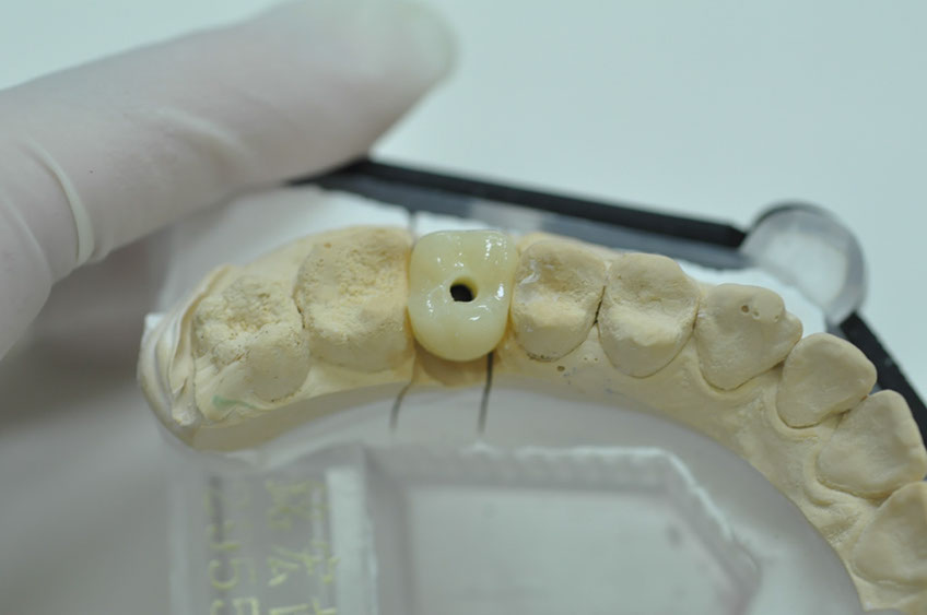 %_tempFileNameImplant%20108c3%