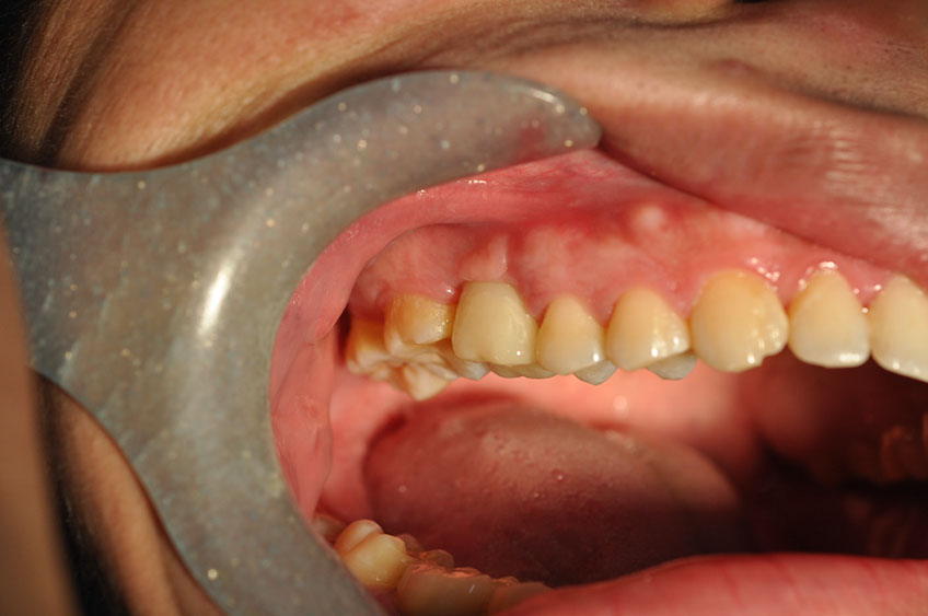 %_tempFileNameImplant%20108c4%