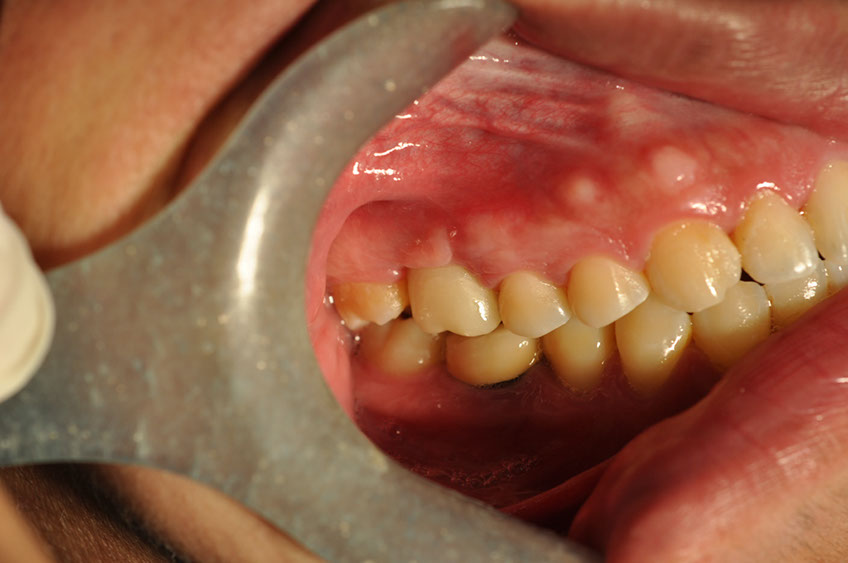 %_tempFileNameImplant%20108c6%