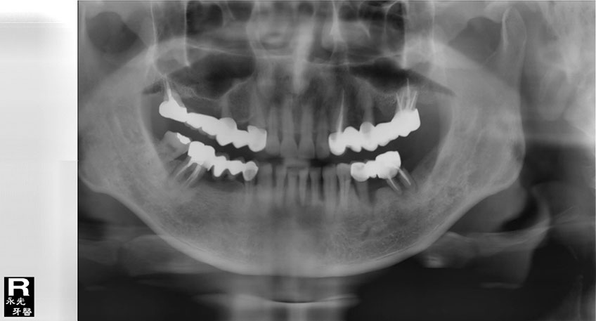 %_tempFileNameImplant%20109a2%