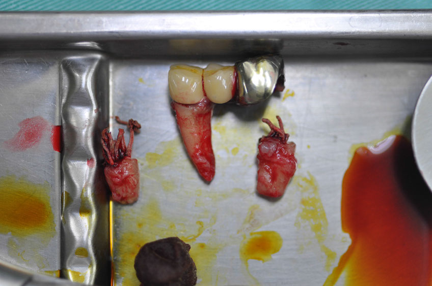 %_tempFileNameImplant%20109a4%