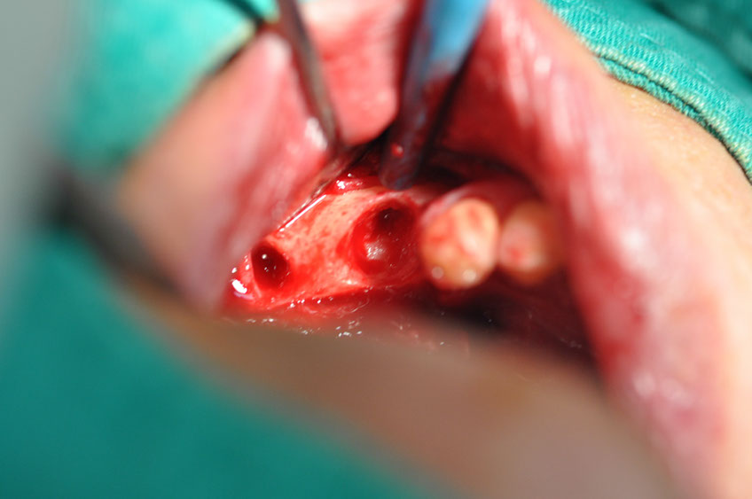 %_tempFileNameImplant%20109a6%