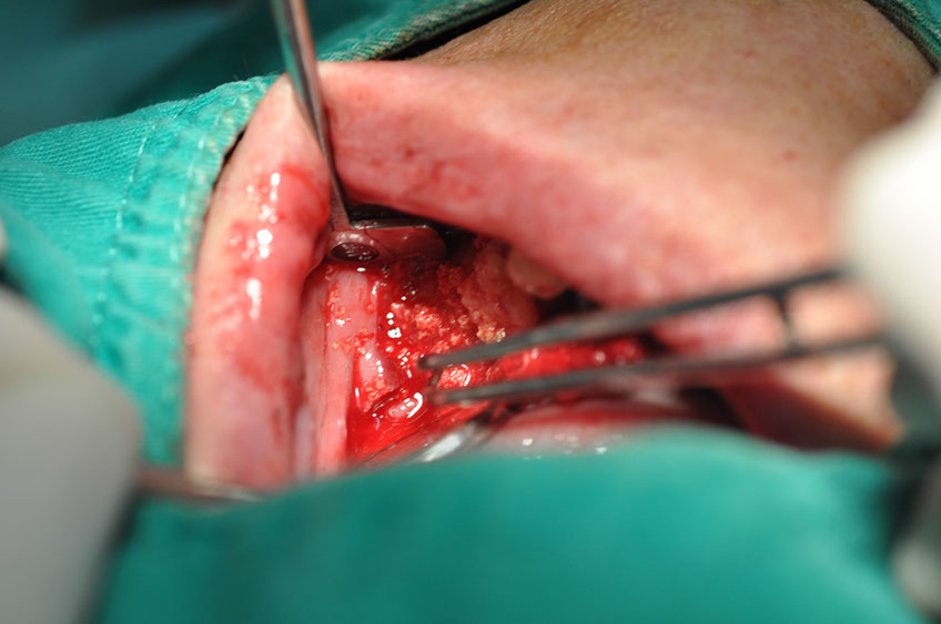 %_tempFileNameImplant%20109b3%