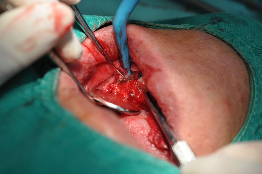 %_tempFileNameImplant%20109b7%