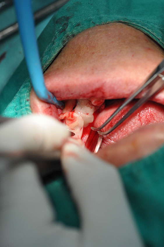 %_tempFileNameImplant%20109b8%