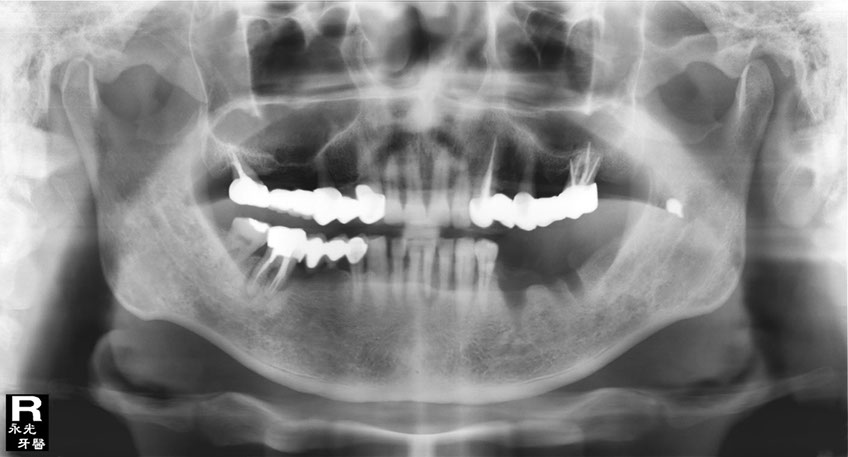 %_tempFileNameImplant%20109c1%