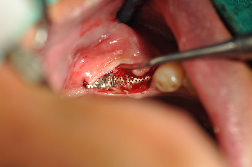 %_tempFileNameImplant%20109c4%