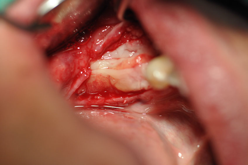%_tempFileNameImplant%20109d4%