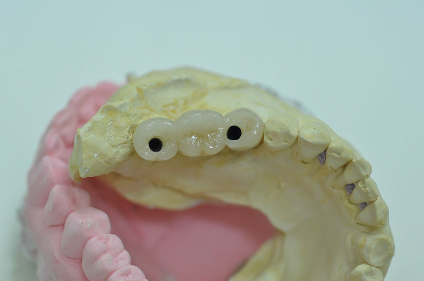 %_tempFileNameImplant%20109e3%