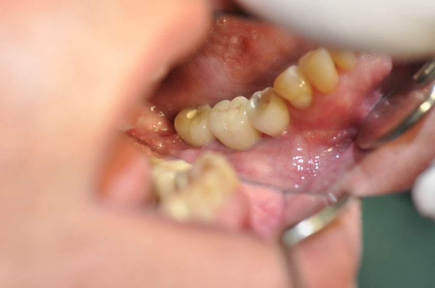 %_tempFileNameImplant%20109e4%