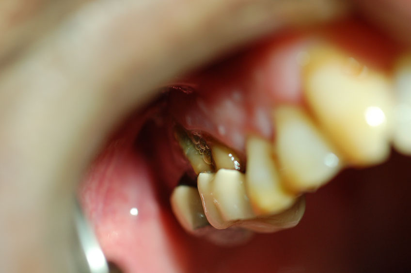 %_tempFileNameImplant%2010a1%