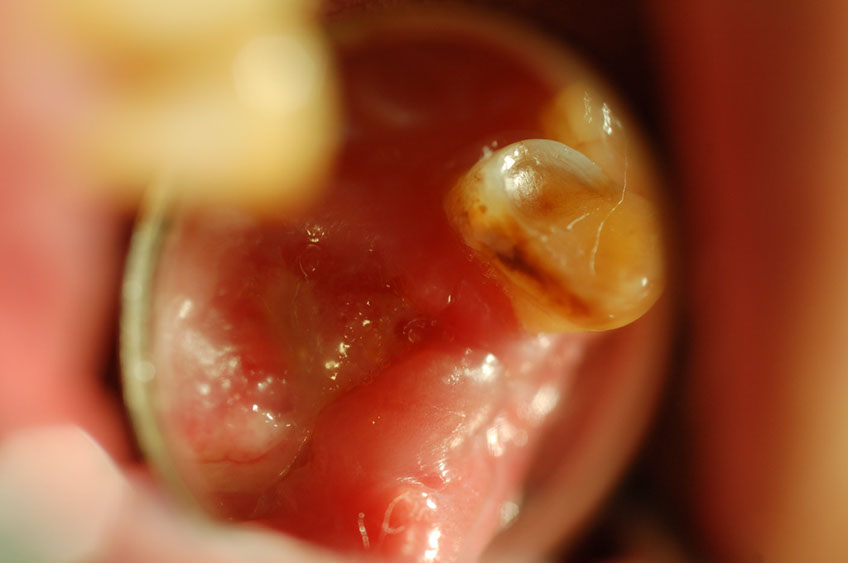 %_tempFileNameImplant%2010d3%
