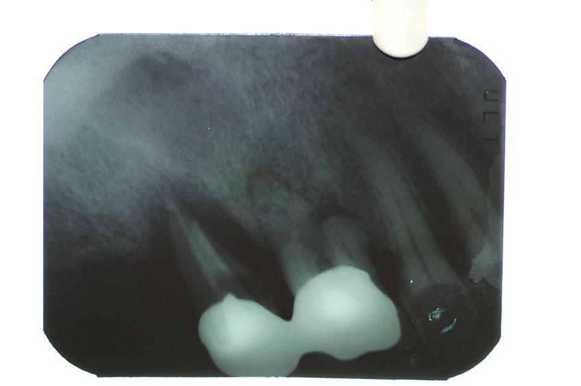 %_tempFileNameImplant%2010e1%