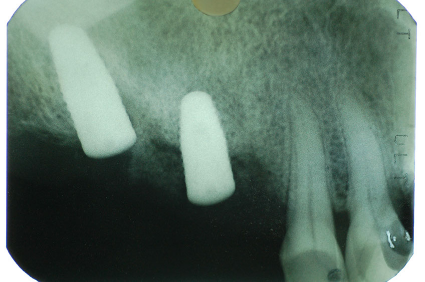 %_tempFileNameImplant%2010e6%