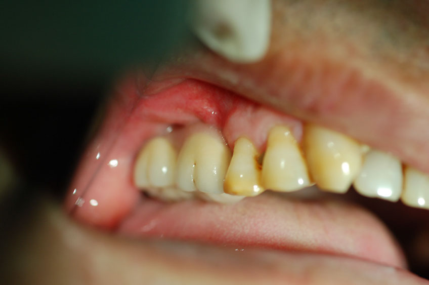%_tempFileNameImplant%2010f3%