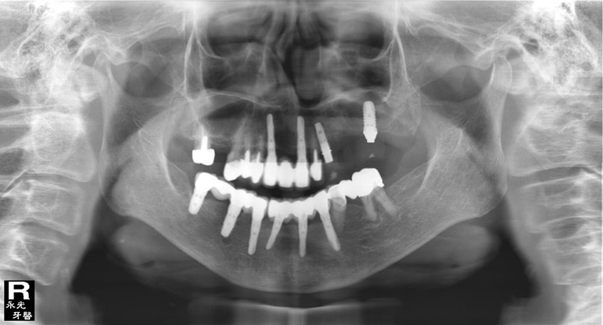%_tempFileNameImplant%20111d7%