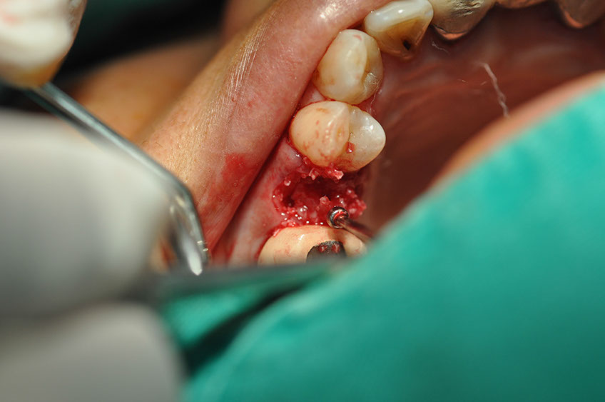 %_tempFileNameImplant%20113a5%