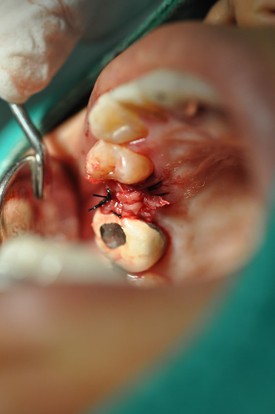 %_tempFileNameImplant%20113a7%