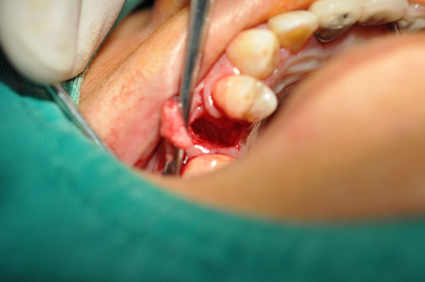 %_tempFileNameImplant%20113b1%