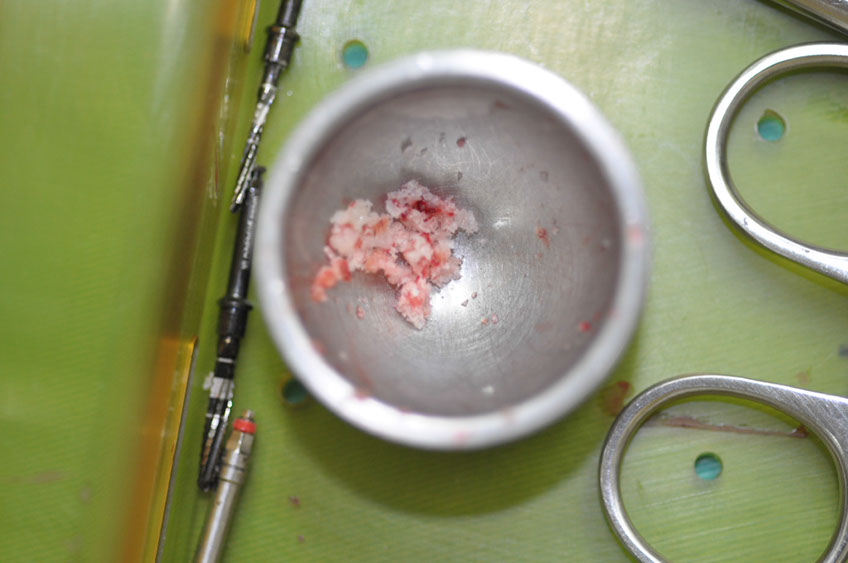 %_tempFileNameImplant%20113b6%