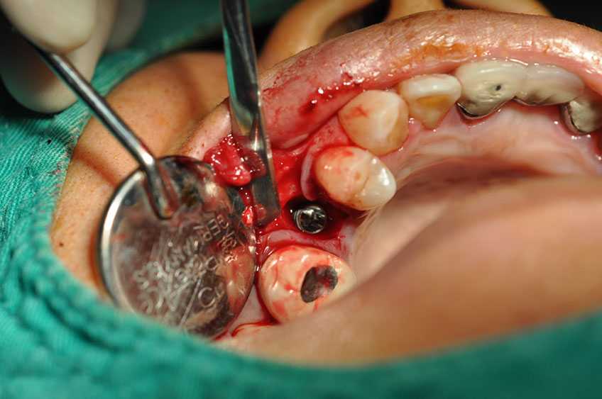 %_tempFileNameImplant%20113b9%