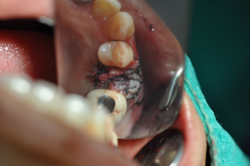 %_tempFileNameImplant%20113c4%