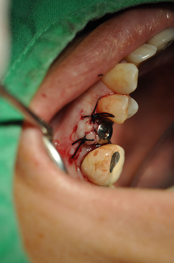 %_tempFileNameImplant%20113c7%